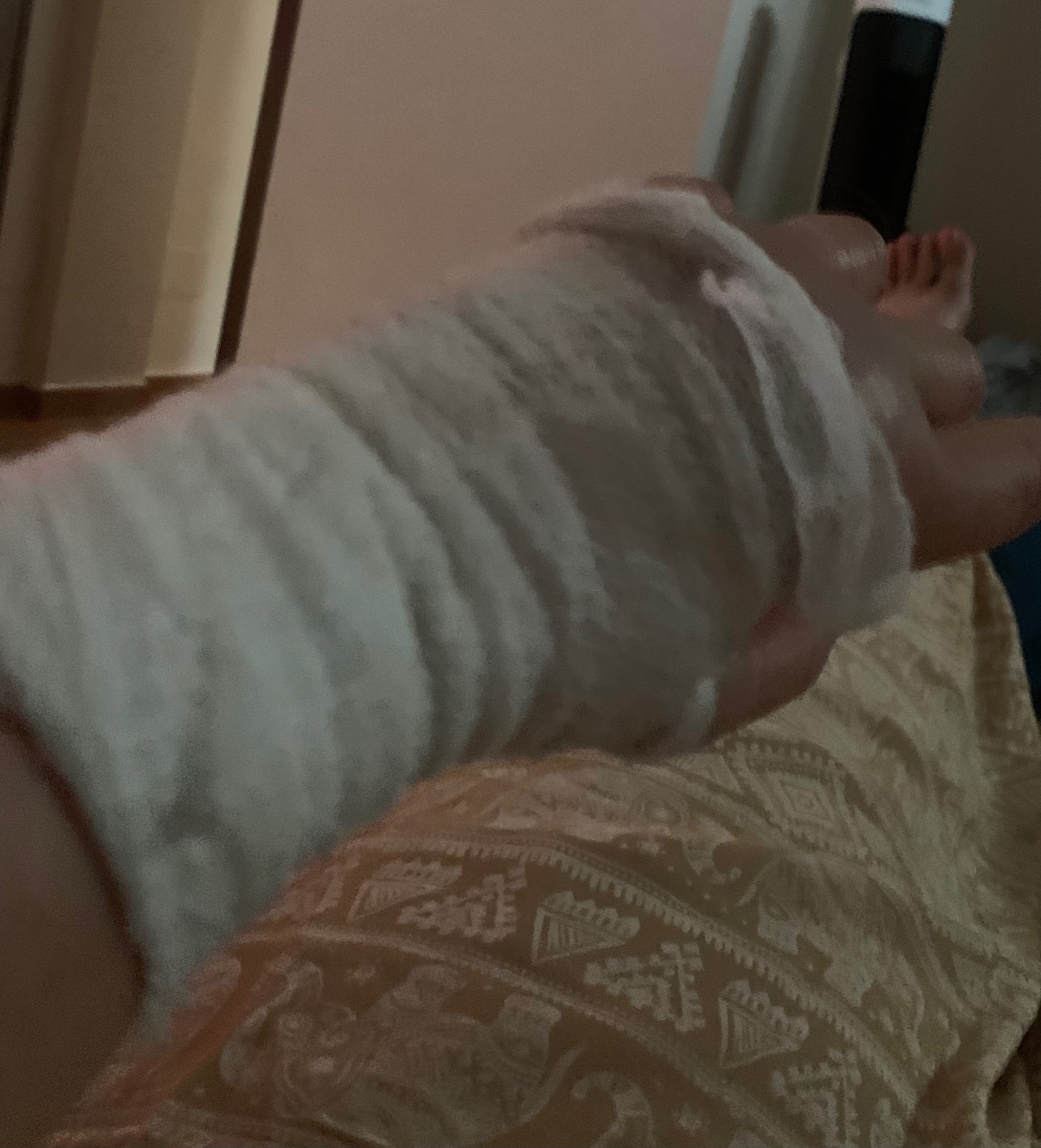 My hand after Affey's shock-attack